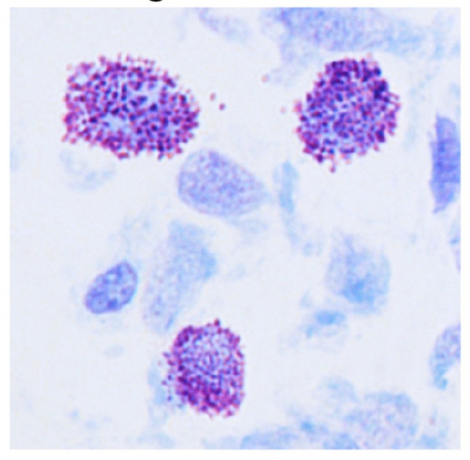 A close-up image of mast cells with their granules under the microscope // Credit: Abhay Rathore