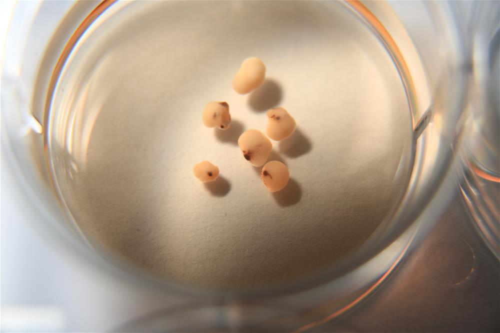 Mini brains grown on a culture plate // Credit: Alfred Sun, Duke-NUS