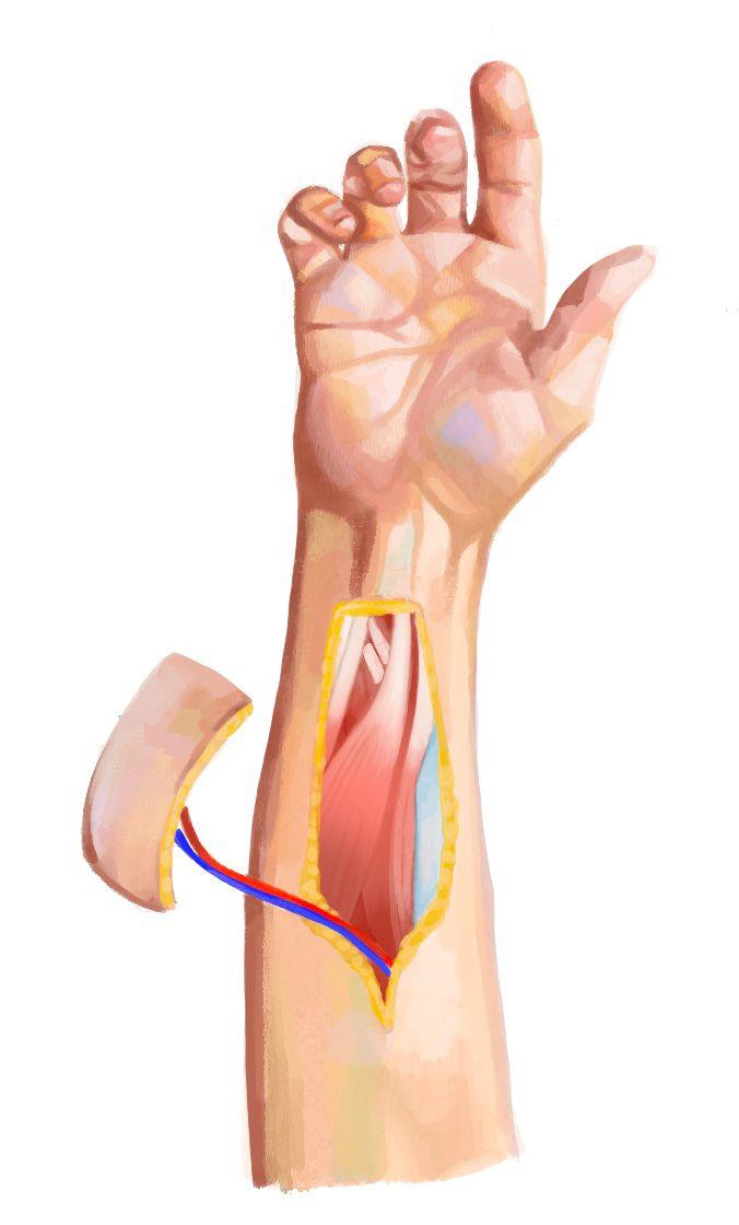 A life-like sketch of the structures in the arm // Credit: Danielle Yap