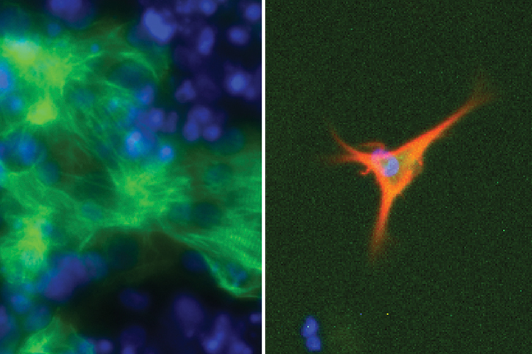 EpiMogrify thumbnail