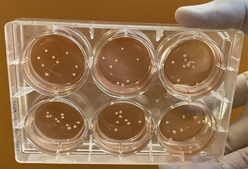 Midbrain-like organoids grown in Shawn Je's lab
