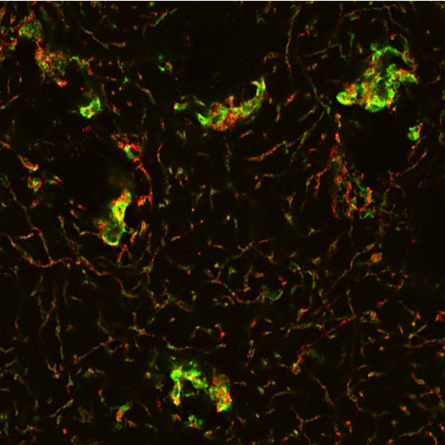 Visualising neurons and their synapses using specialised stains // Credit: Courtesy of Cao Mian