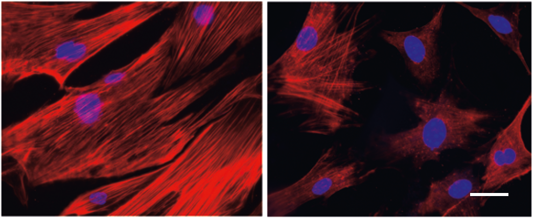 Duke-NUS scientists show that the WWP2 gene plays a critical role in advancing tissue scarring in chronic kidney disease in these side by side microscopy images