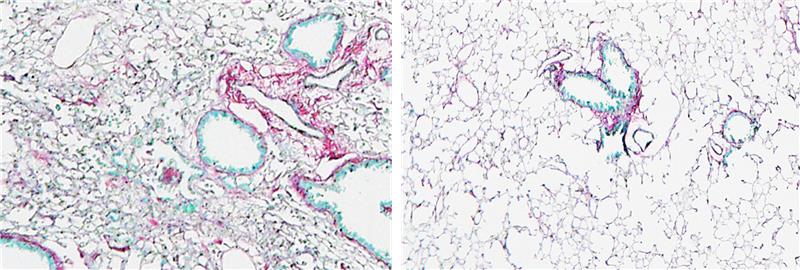 Lung tissue showing scarring in an induced fibrosis model (right); while WWP2 inhibition protects tissue structure from fibrosis (left) // Image credit: Chen Huimei, Duke-NUS Medical School
