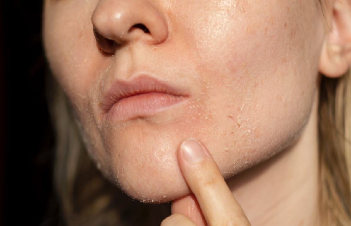 Duke-NUS scientists uncover key “lipid transporter” that keeps skin healthy